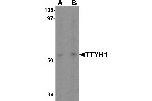Western blot analysis of TTYH1 in Raji cell lysate with TTYH1 antibody at (A) 1 and (B) 2 µg/mL. (TTYH1 Antikörper  (C-Term))