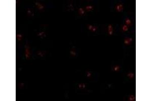 Immunofluorescence of Integrin alpha 4 in Jurkat cells with AP30436PU-N Integrin alpha 4 antibody at 2 μg/ml. (ITGA4 Antikörper  (Center))