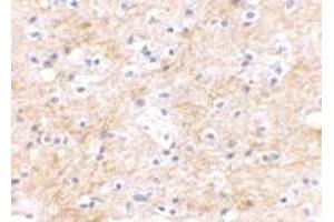 Immunohistochemical staining of human brain tissue using DLGAP3 polyclonal antibody  at 2. (DLGAP3 Antikörper  (C-Term))