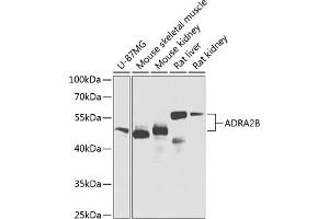 Western blot analysis of extracts of various cell lines, using B Antibody (ABIN6134019, ABIN6136597, ABIN6136598 and ABIN6224629) at 1:1000 dilution. (ADRA2B Antikörper  (AA 1-100))