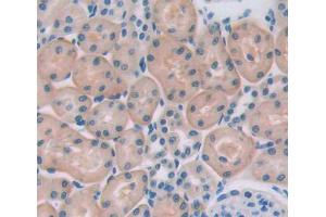Used in DAB staining on fromalin fixed paraffin-embedded testis tissue (HSPA2 Antikörper  (AA 1-633))