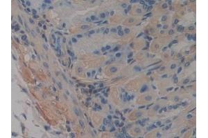 Immunohistochemistry (IHC) image for anti-ATP-Binding Cassette, Sub-Family A (ABC1), Member 1 (ABCA1) (AA 1404-1663) antibody (ABIN7433312)