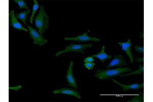 Immunofluorescence of purified MaxPab antibody to FAM60A on HeLa cell. (FAM60A Antikörper  (AA 1-221))