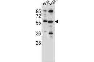 Western Blotting (WB) image for anti-Cysteine Sulfinic Acid Decarboxylase (CSAD) antibody (ABIN2996373) (CSAD Antikörper)