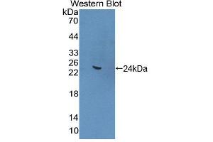 Western blot analysis of the recombinant protein. (ANGPTL4 Antikörper  (AA 228-389))