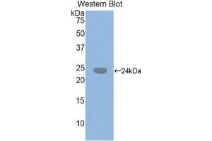 Western Blotting (WB) image for anti-Glutathione Synthetase (GSS) (AA 270-474) antibody (ABIN1859086) (Glutathione Synthetase Antikörper  (AA 270-474))