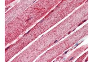 Human Skeletal Muscle (formalin-fixed, paraffin-embedded) stained with BAK1at 10 µg/ml followed by biotinylated goat anti-rabbit IgG secondary antibody, alkaline phosphatase-streptavidin and chromogen. (BAK1 Antikörper  (N-Term))