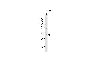 Western blot analysis of lysate from Jurkat cell line, using OSM Antibody at 1:1000 at each lane. (Oncostatin M Antikörper  (C-Term))