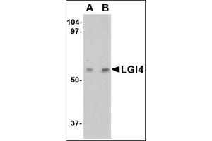 Western blot analysis of LGI4 in human brain tissue lysate with this product at (A) 1 and (B) 2 μg/ml. (LGI4 Antikörper  (Center))