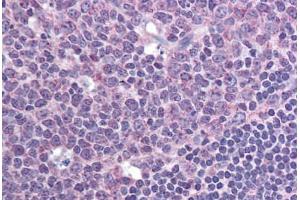 Human Tonsil (formalin-fixed, paraffin-embedded) stained with CXCR7 antibody ABIN295878 at 10 ug/ml followed by biotinylated goat anti-rabbit IgG secondary antibody ABIN481713, alkaline phosphatase-streptavidin and chromogen. (CXCR7 Antikörper  (AA 100-150))