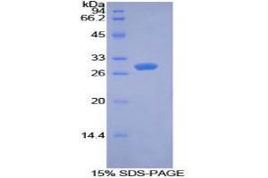 SDS-PAGE analysis of Mouse PDK1 Protein.