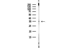 Western blot analysis of lysates from 3-L1 P6(heat-shock, 45 min treatment), using SLC25 Antibody at 1/1000 dilution.
