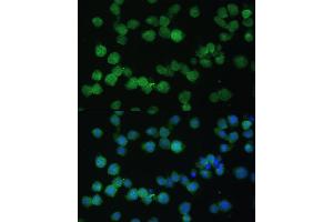 Immunofluorescence analysis of THP-1 cells using CD35/CD35/CR1 antibody (ABIN6130075, ABIN6138990, ABIN6138991 and ABIN6214176) at dilution of 1:100. (CD35 Antikörper  (AA 420-550))