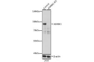 Western blot analysis of extracts from normal (control) and ADRBK1 knockout (KO) 293T cells using ADRBK1 Polyclonal Antibody at dilution of 1:500. (GRK2 Antikörper)