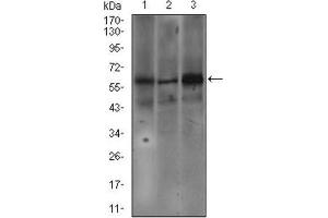 Western Blotting (WB) image for anti-Fc Fragment of IgE Receptor Ia (FCER1A) (AA 42-103) antibody (ABIN1845339) (Fc epsilon RI/FCER1A Antikörper  (AA 42-103))