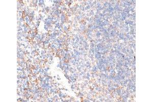 Immunohistochemistry of paraffin-embedded Mouse spleen using GPC3 Polyclonal Antibody at dilution of 1:100 (40x lens). (Glypican 3 Antikörper)