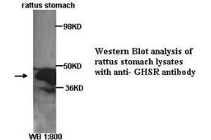 Image no. 1 for anti-Growth Hormone Secretagogue Receptor (GHSR) (C-Term) antibody (ABIN790871) (GHSR Antikörper  (C-Term))