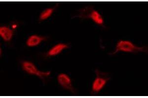 ABIN6266959 staining 293 by IF/ICC. (TAF6L Antikörper  (N-Term))