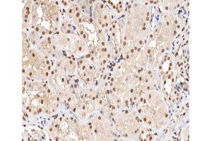 ABIN6266470 at 1/200 staining human kidney tissue sections by IHC-P.