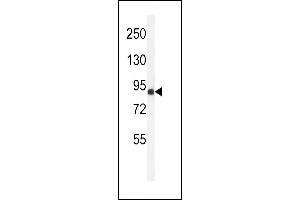 Western blot analysis of ANR49 Antibody (Center) (ABIN651157 and ABIN2840103) in Jurkat cell line lysates (35 μg/lane). (ANKRD49 Antikörper  (AA 80-109))