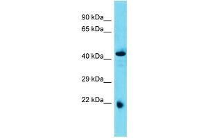 Host: Rabbit  Target Name: Abhd4  Sample Tissue: Rat Pancreas lysates  Antibody Dilution: 1. (ABHD4 Antikörper  (N-Term))