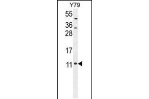 Western blot analysis in Y79 cell line lysates (35ug/lane). (NDUFA11 Antikörper  (AA 64-92))