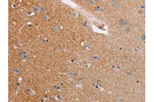 The image on the left is immunohistochemistry of paraffin-embedded Human brain tissue using ABIN7128771(CASC3 Antibody) at dilution 1/20, on the right is treated with fusion protein. (CASC3 Antikörper)