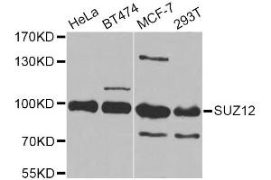 Western blot analysis of extracts of various cell lines, using SUZ12 Antibody. (SUZ12 Antikörper)