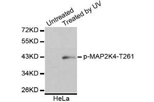 Western blot analysis of extracts of HeLa cells, using Phospho-MAP2K4-T261 antibody (ABIN5995644). (MAP2K4 Antikörper  (pThr261))