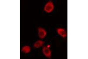 ABIN6274133 staining HeLa cells by IF/ICC. (ZNF265 Antikörper  (Internal Region))