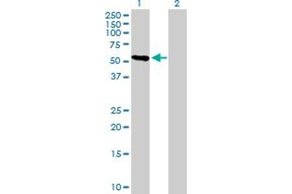 CRTAC1 Antikörper  (AA 1-451)