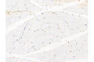 Phospho-Rab10 (Thr73) Antibody at 1/100 staining Rat muscle tissue by IHC-P.