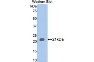 Detection of Recombinant MMP13, Rabbit using Polyclonal Antibody to Matrix Metalloproteinase 13 (MMP13) (MMP13 Antikörper  (AA 70-245))