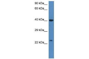 Western Blot showing PRSS1 antibody used at a concentration of 1 ug/ml against HT1080 Cell Lysate