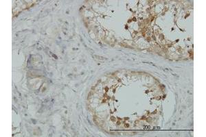Image no. 3 for anti-A Kinase (PRKA) Anchor Protein 10 (AKAP10) (AA 1-101) antibody (ABIN599175) (AKAP10 Antikörper  (AA 1-101))
