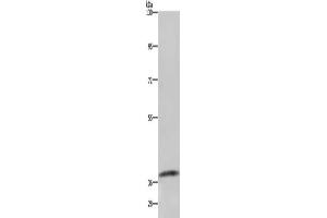 Gel: 6 % SDS-PAGE, Lysate: 40 μg, Lane: Mouse kidney tissue, Primary antibody: ABIN7129587(GDF3 Antibody) at dilution 1/250, Secondary antibody: Goat anti rabbit IgG at 1/8000 dilution, Exposure time: 1 minute (GDF3 Antikörper)