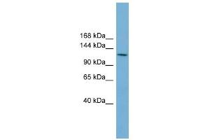 CDC27 antibody used at 1 ug/ml to detect target protein. (CDC27 Antikörper)