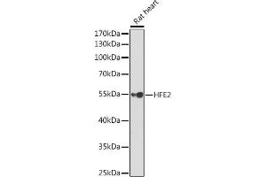 Western Blotting (WB) image for anti-Hemochromatosis Type 2 (Juvenile) (HFE2) (AA 1-174) antibody (ABIN6141738)