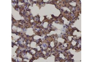 IHC analysis of RAGE/AGER using anti-RAGE/AGER antibody (ABIN7603153). (RAGE Antikörper  (N-Term))