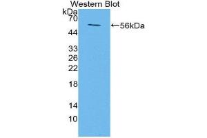 Western Blotting (WB) image for anti-Transmembrane Protein 27 (TMEM27) (AA 12-222) antibody (ABIN1871656)