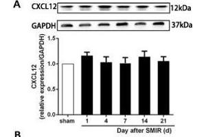 The CXCR7 and PI3K/Akt signaling pathways are involved in CPSP in the dorsal horn of the spinal cord. (GAPDH Antikörper)