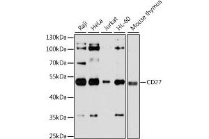Western blot analysis of extracts of various cell lines, using CD27 antibody. (CD27 Antikörper)