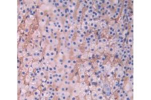 Used in DAB staining on fromalin fixed paraffin- embedded adrenal gland tissue (CYP17A1 Antikörper  (AA 183-508))