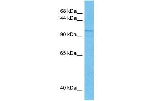 Host:  Mouse  Target Name:  SIN3B  Sample Tissue:  Mouse Spleen  Antibody Dilution:  1ug/ml (SIN3B Antikörper  (N-Term))