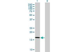 Western Blot analysis of TNFAIP8L2 expression in transfected 293T cell line by TNFAIP8L2 MaxPab polyclonal antibody. (TNFAIP8L2 Antikörper  (AA 1-184))