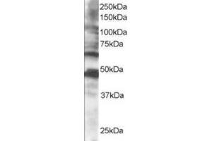 Image no. 1 for anti-Cytoplasmic Polyadenylation Element Binding Protein 1 (CPEB1) (C-Term) antibody (ABIN374439) (CPEB1 Antikörper  (C-Term))