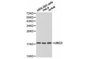 Western Blotting (WB) image for anti-Ubiquitin-Conjugating Enzyme E2I (UBE2I) antibody (ABIN1875255) (UBE2I Antikörper)