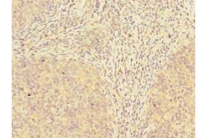 Immunohistochemistry of paraffin-embedded human tonsil tissue using ABIN7173532 at dilution of 1:100 (ADAT1 Antikörper  (AA 1-501))