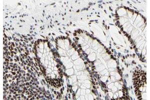 ABIN6266668 at 1/100 staining human colon tissue sections by IHC-P. (UBA2 Antikörper  (C-Term))