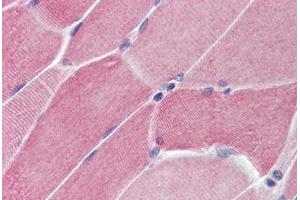 Human Skeletal Muscle (formalin-fixed, paraffin-embedded) stained with PTPN11 antibody ABIN214466 at 5 ug/ml followed by biotinylated goat anti-rabbit IgG secondary antibody ABIN481713, alkaline phosphatase-streptavidin and chromogen. (PTPN11 Antikörper  (N-Term))